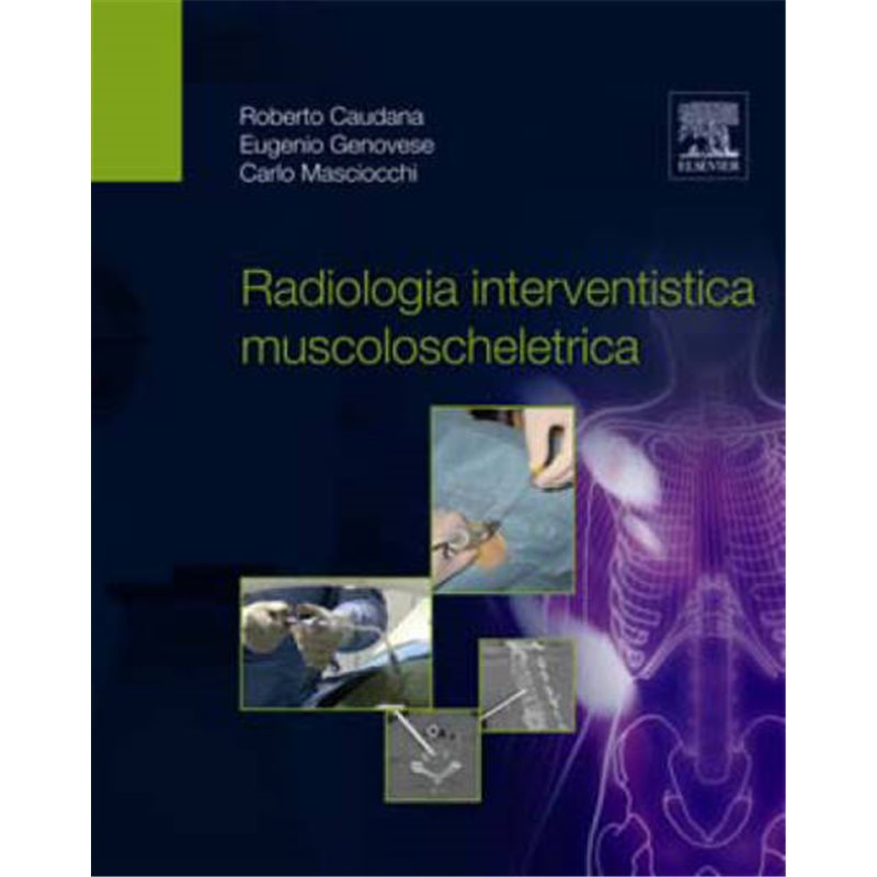 Radiologia interventistica muscoloschelettrica - con DVD
